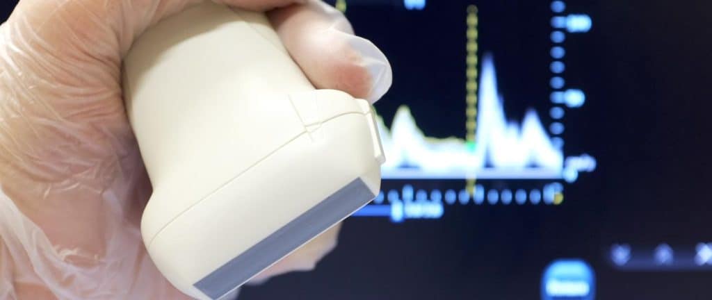 Zbliżenie na głowicę ultrasonograficzną. W tle aparat USG